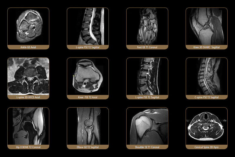 ESAOTE S-SCAN Open Dedicate MRI - 2010 WITH CAGE