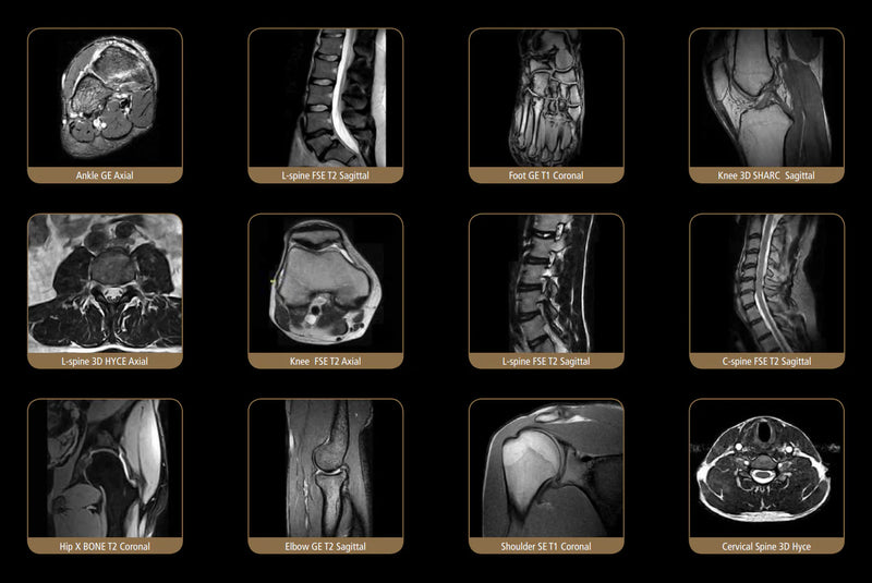 ESAOTE S-SCAN Open Dedicate MRI - 2012 WITH FARADY CAGE