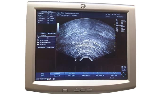 GE Logiq P5 Ultrasound System with Transducers