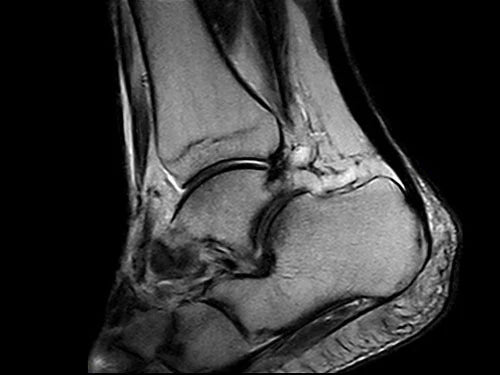 ESAOTE O-SCAN eXP 2017 - Dedicate MRI for Extremities