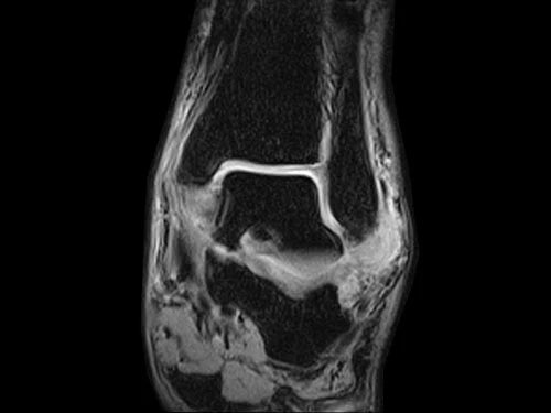 ESAOTE O-SCAN eXP 2017 - Dedicate MRI for Extremities