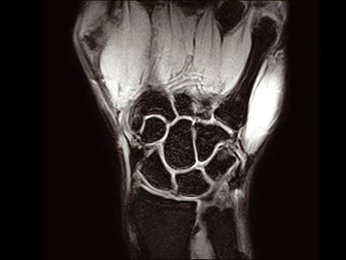 ESAOTE O-SCAN eXP 2016 - Dedicate MRI for Extremities with Cage